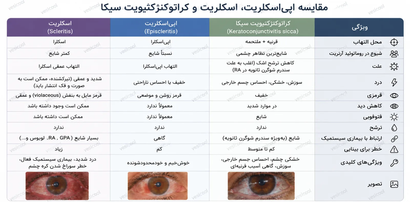 تظاهرات آرتریت روماتوئید و درگیری چشمی آن